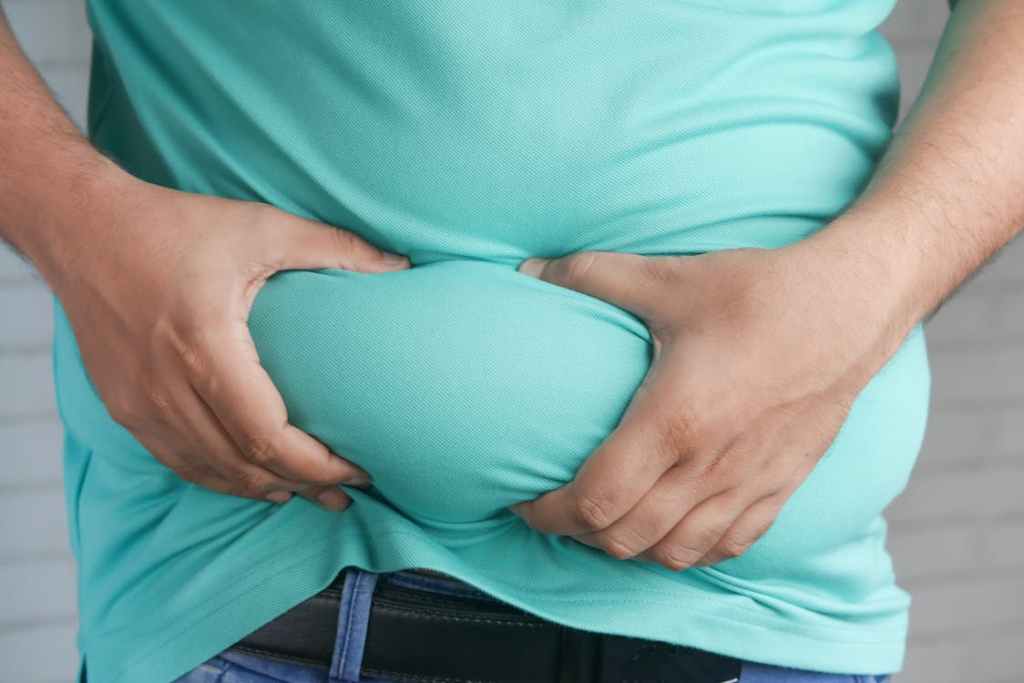 Understanding Obesity: A Global Health&nbsp;Concern
